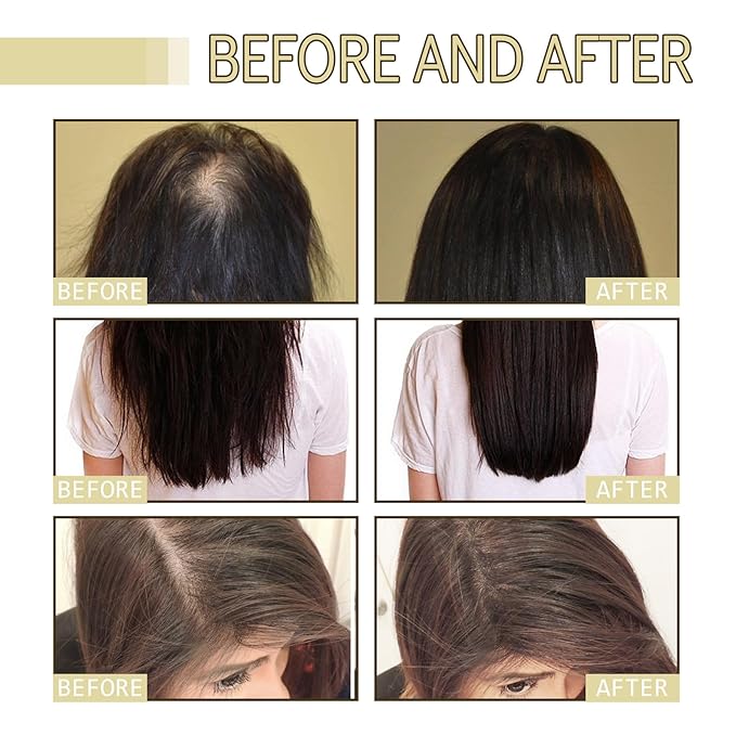 180 ML EELHOE Hair Growth Oil, Natural Rosemary Hair Growth Oil for Dry Damaged Hair and Growth Thin Hair. (3Pcs)