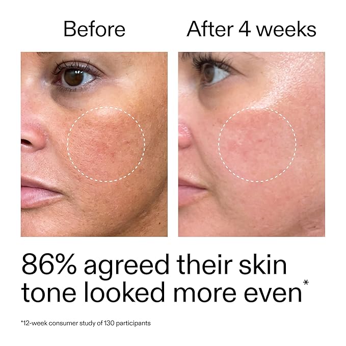 The INKEY List Starter Dual Retinol Serum 1 Fl Oz, 0.5% Amisol Trio & 0.2% Symrelief, Gentle Skin Renewal, Smooths Fine Lines, Hydration & Barrier Protection, Suitable for Sensitive Skin