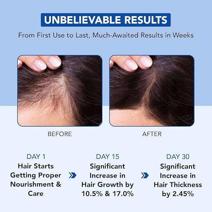 Botanic Hearth Hair Oil for Hair Growth | Rosemary Oil for Hair Growth with Biotin, Castor & Jojoba | Hair Relaxers & Dry Scalp Treatment | Color Safe | All Hair Types | 4 Fl Oz