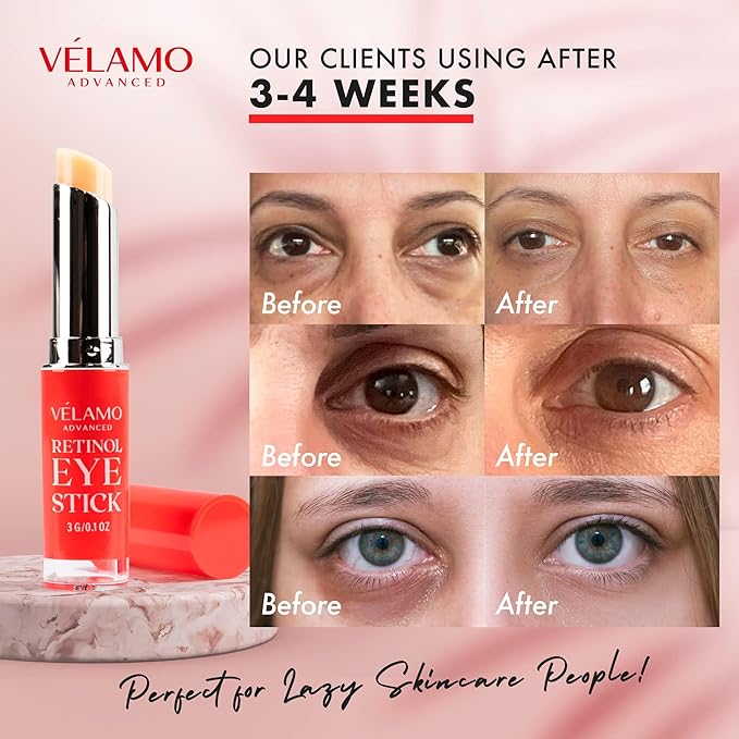 VELAMO ADVANCED Retinol Eye Stick: Renewing & Firming Under Eye Balm for Dark Circles, Puffiness, Fine Lines & Wrinkles - Travel Essentials, Portable & Perfect for On-the-go Use, 0.1 OZ/3g 2 Pcs