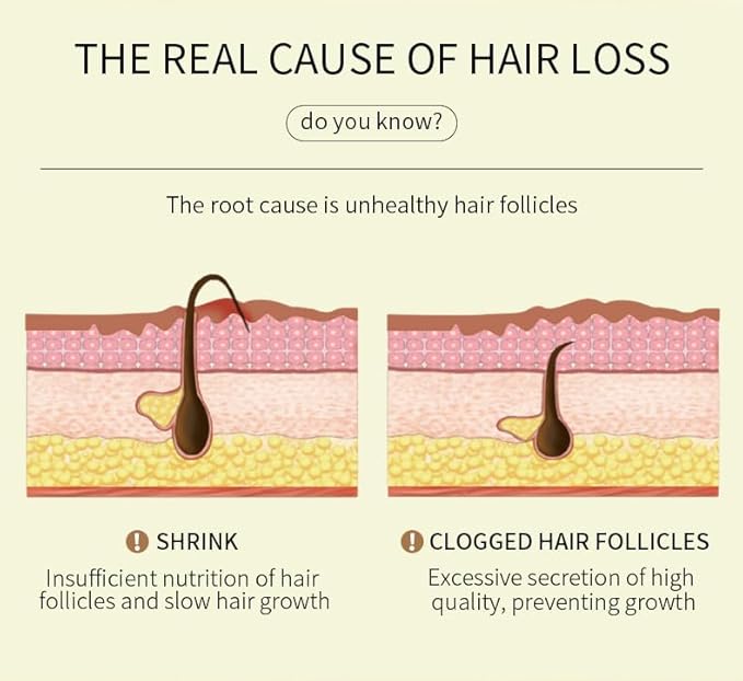 180 ML EELHOE Hair Growth Oil, Natural Rosemary Hair Growth Oil for Dry Damaged Hair and Growth Thin Hair. (3Pcs)