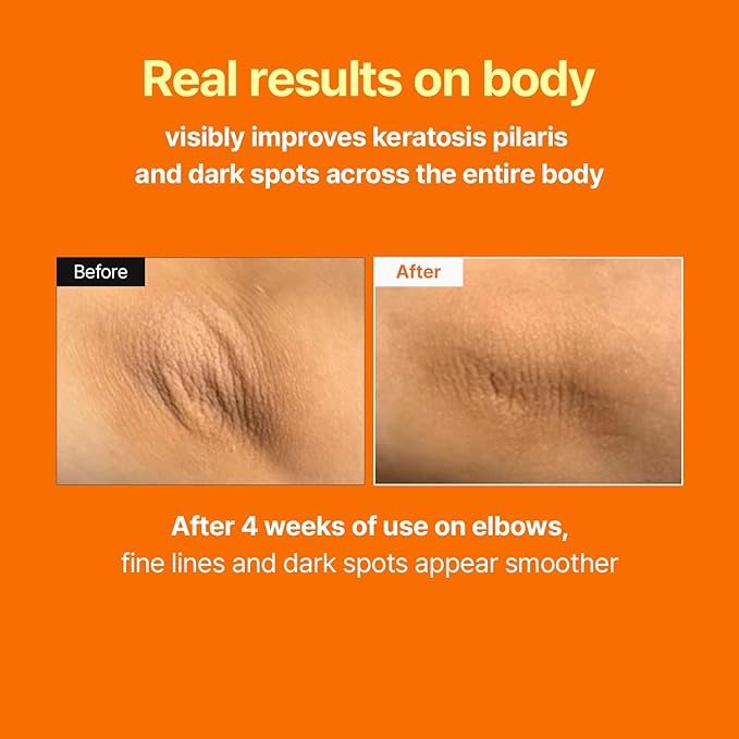 MEDITHERAPY Retinal Skin Booster Serum – Gentle Daily Serum for Beginners, Lightweight Face & Body Serum – Smooth Texture & Pore Care – Korean Skincare, 5.07 Fl. Oz