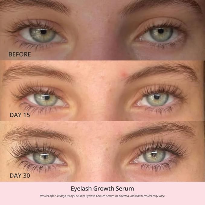 ForChics Eyelash Growth Serum - Prostaglandin-Free Lash Enhancing Serum for Longer, Thicker Lashes and Brows- Natural Formula, Visible Results in 2 Weeks - Vegan, Hormone-Free 0.10 fl. oz / 3ml