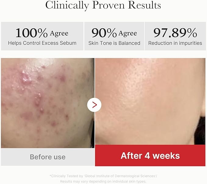 medicube Toner Pads Red Succinic Acid Panthenol Facial Peeling Pad | Exfoliating Toner Pad for Breakout-Prone Skin | Niacinamide, AHA, BHA, and Soothing Panthenol - Non-Comedogenic, 70 Pads (1 Pack)