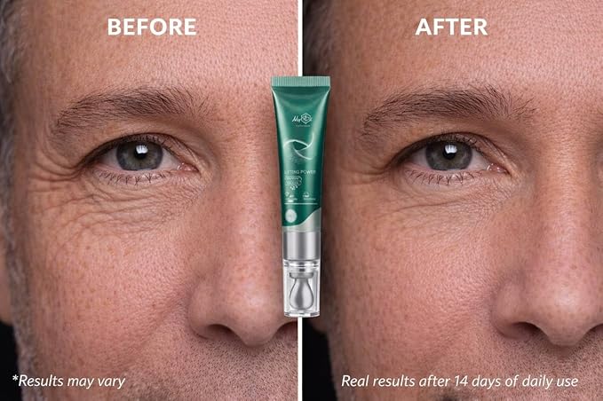 Rejuvenating Anti Aging Serum - Lifting Power Eye Fluid - Hydrating Eye Wrinkle Cream for Women with 5 Peptides & Vitamins - Ceramide, Hyaluronic Acid, Vitamin C, Palmitoyl Tripeptide-1-15ml