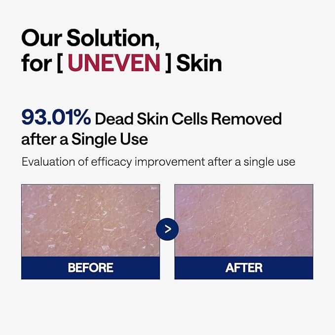 MEDIHEAL Toner Pads [Phyto Enzyme] - Exfoliating Peeling Pad with LHA & Papaya Enzyme - Pore Tightening & Sebum Control - Vegan Micro Embossed Non-Sensitive Pad (90 Count)