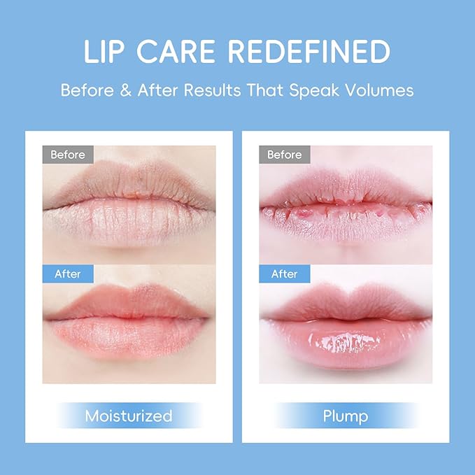 AKARY 10Pcs Milk Hydrating Lip Mask, Sleep Crystal Jelly Gel Care Pads, Moisturizing Wrinkle Firm Hydrate Lips, Soften Cutin, Nourish, Keep Plump, Remove Dead Skin, Fine Lines, Make Your Dry Lip (10)