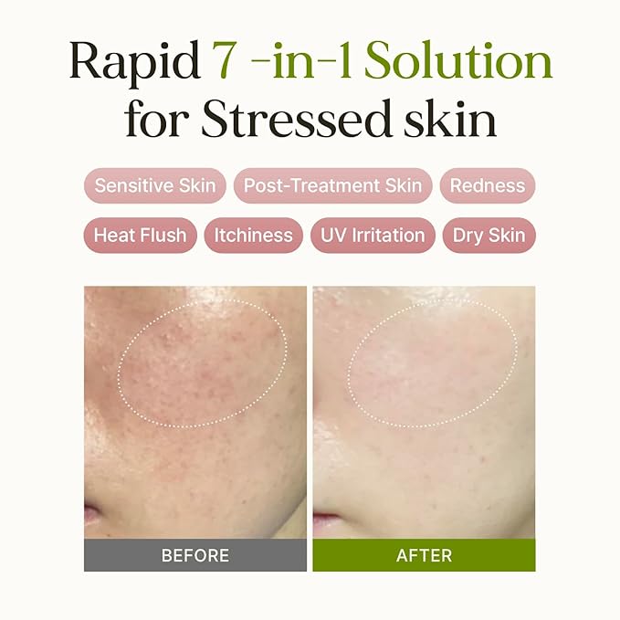 7 Relief Ampoule Pad (60 Pads) – Quick Calming & Soothing Toner Pads with 7 Herbal Blend, Moisturizing Comfort for Stressed and Sensitive Skin | Family-Friendly Vegan Korean Skincare