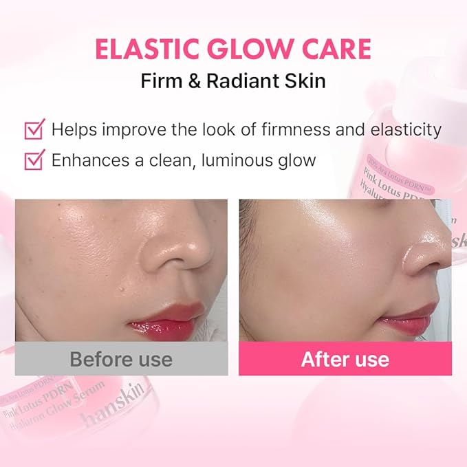 Hanskin PDRN Pink Peptide Hyaluron Glow Serum - 200,000ppm Pink Lotus Vegan PDRN | Intensive Hydrating Glow Ball Essence for Glass Skin, Plumping & Firming | Korean Skincare 1.01 fl. oz.