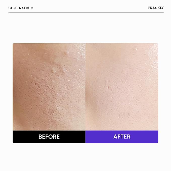 FRANKLY Pore-Perfecting Duo: Closer Serum & AHA 8.05 Toner | Skincare Gifts | Pore Minimizer, Anti-Aging, Glycolic Acid & Peptide Formula | Smooth Texture & Radiance | Korean Skin Care Set