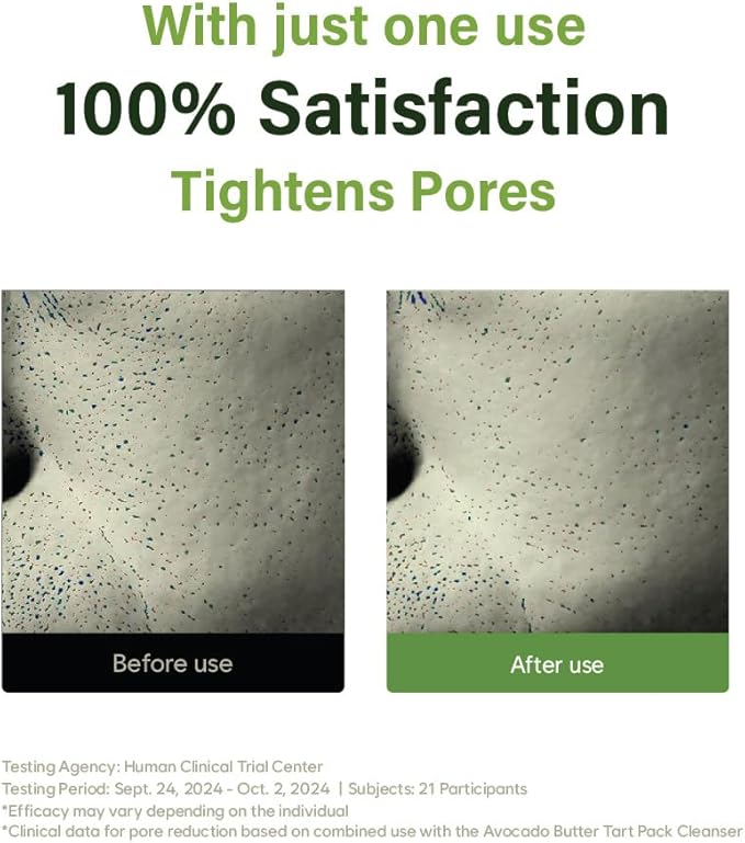 Cypress Aloe Calming Toner Pads [70 Sheets] – Instantly Cooling & Soothing Toner with Centella Asiatica, Reduce Redness & Pore Care, Vegan, Dermatologist-Tested for Sensitive & Acne-Prone Skin