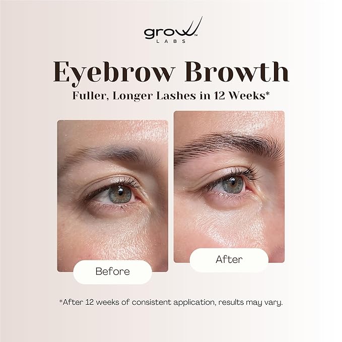 Eyebrow Growth Serum – with Biotin & Peptides – Regrow Eyebrow Hair – Nourishing Formula for Thicker, Fuller, Natural-Looking Brows – Vegan, Cruelty-Free – Made in USA – 5 ml
