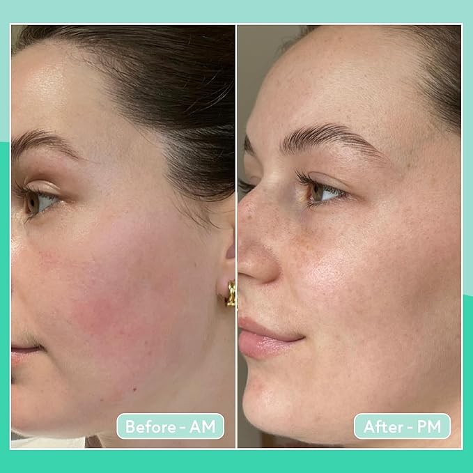 Q+A Cica Overnight Face Mask (50g), Calming, Hydrating and Barrier-Strengthening Face Care, Sleeping Mask for Sensitive, Stressed and Dry Skin, With Centella Asiatica, Vegan Skincare