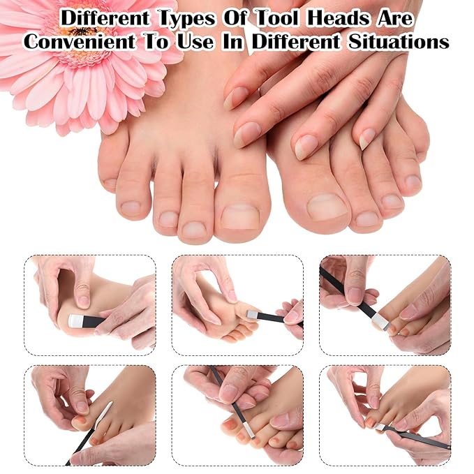 5 Pcs Ingrowing Toenail Kit Pedicure Tools Professional Stainless Steel Ingrown Toenail Treatment Clippers File and Lifters for Men Women Pedicure Kit
