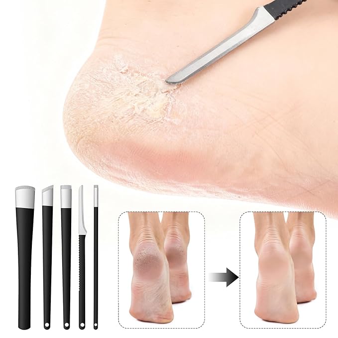 5 Pcs Ingrowing Toenail Kit Pedicure Tools Professional Stainless Steel Ingrown Toenail Treatment Clippers File and Lifters for Men Women Pedicure Kit