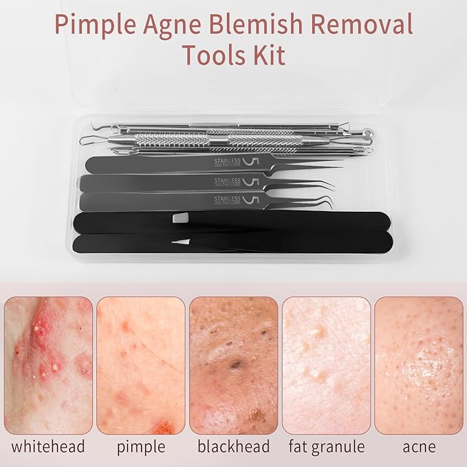 Blackhead Remover Tools, 8 Pack Pimple Popper Tool Kit, 4 Pack Tweezers Set, Quickly and Easily Removes Acne and Blackheads, Precision Eyebrow Tweezers for Facial Hair