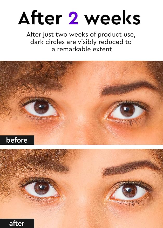 bewants Under Eye Cream for Dark Circles, Cream Stick for Puffiness, Bags, and Wrinkles, Korean Skincare Solution for Tired Skin Around the Eyes (1 Pack)