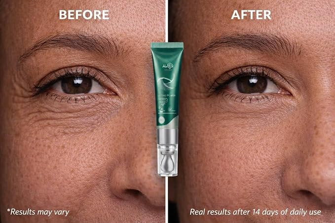 Rejuvenating Anti Aging Serum - Lifting Power Eye Fluid - Hydrating Eye Wrinkle Cream for Women with 5 Peptides & Vitamins - Ceramide, Hyaluronic Acid, Vitamin C, Palmitoyl Tripeptide-1-15ml