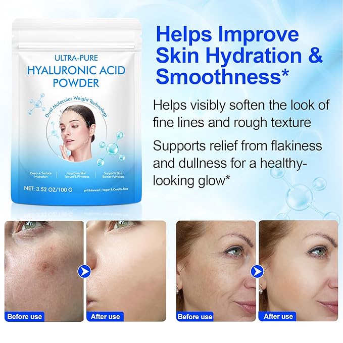 2pack Hyaluronic Acid Powder for Skin Face, Hyaluronic Acid Serum Powder, Low Molecular Weight, Cosmetics Grade,Natural Ingredient for Skincare,Skin Hydration Moisture Support Supplements,Facial Serum