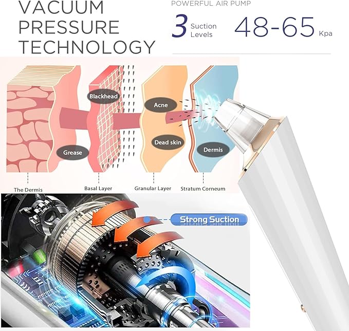 Blackhead Remover Pore Vacuum, Upgraded USB Rechargeable Facial Pore Cleaner Blackhead Removal Kit with 3 Suction Power,5 Probes Black Head Extractions Tool for Women & Men