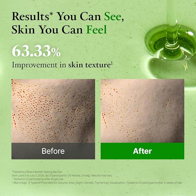 FULLY Green Tomato Acid 20 Exfoliating Wash Off Serum, 21% AHA+BHA+PHA for Dead Skin, Magic Green Potion, Body Exfoliator, for Strawberry Skin, Smooth Texture, Korean Vegan Skincare, 1.69 fl.oz