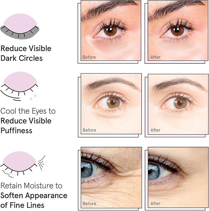 grace & stella Award Winning Under Eye Mask Reduce Dark Circles, Puffy Eyes, Undereye Bags, Wrinkles, Gel Under Eye Patches, Get Well Gifts for Women - Vegan Eye mask (24 Pairs, Blue)