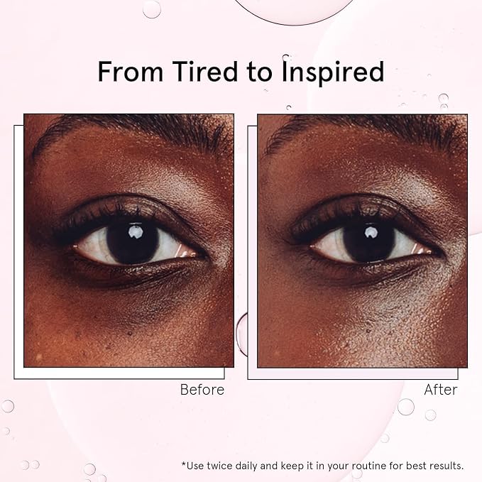 grace & stella Under Eye Brightener with Cooling Metal Rollerball - Centella Asiatica & Caffeine Eye Serum for Puffy Eyes - Travel Essentials - Under Eye Cream - Vegan Skincare (15ml / 0.51floz)