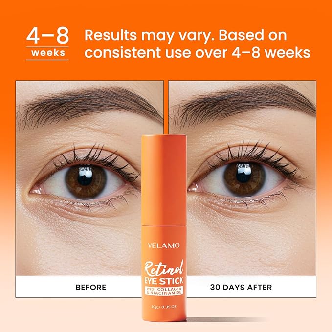 VELAMO ADVANCED Retinol Eye Stick: Plumping & Smoothing Under Eye Balm for Dark Circles, Puffiness & Wrinkles - Made in Korea, Upgraded Formula with Collagen, Niacinamide & Peptides 0.35 OZ/10g 2 Pcs