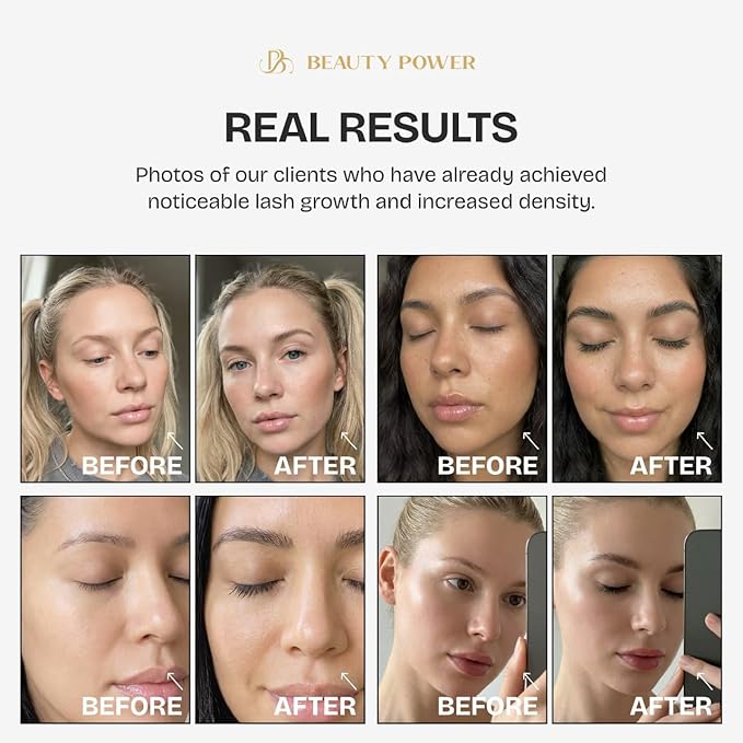 Eyelash Serum & Eyebrow Conditioner - Prostaglandin-Free & Hormone-Free - Dual Peptides & Vitamin B5 for Thicker Fuller Lashes - Safe for Sensitive Eyes - 5ml (3-Month Supply)