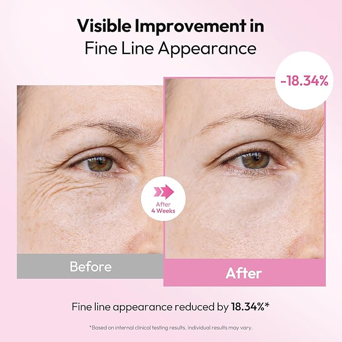 Recipe Milkfiline Boosting Ampoule - Age-Defying, Soothing & Hydrating Face Serum with 5% Volufiline, Niacinamide & Azelaic Acid for Dull, Dry Skin - Lightweight, Firming Korean Skin Care 1.01 fl oz