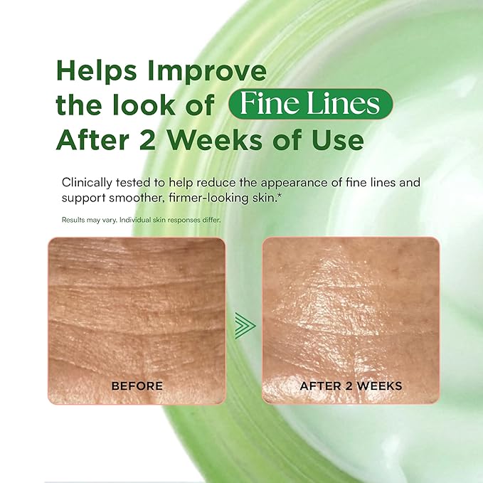 Matcha Hydrating Facial Moisturizer, Rose PDRN All-in-One Skin Face Cream for Redness, Dark Spot, Acne-Prone Skin, Brightening, Anti-Aging, Barrier Support Cream, Korean Skincare 3.53 oz