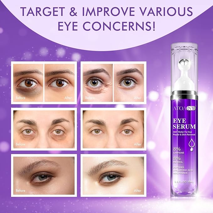 Eye Treatment Serum - 8% Caffeine & Retinol, Hyaluronic Acid, Niacinamide, Peptides - Cream for Dark Circles, Puffy Eyes, Fine Lines - 360° Eye Roller Massage Ball Included, 0.5 fl. oz