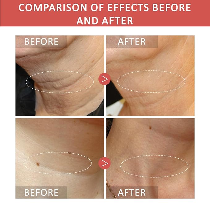 Glossy Smoothing Body Serum for Neck & Body – Hydrating Firming Gel with Niacinamide, Peptides & Hyaluronic Acid – Improves Skin Texture, Lightweight Vegan Formula – 100ml (1)