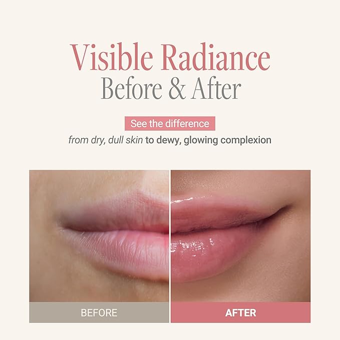 ANILLO Rose Glow Balm - Korean Tinted Lip and Cheek Balm w/Rose Extract, Shea Butter, Ceramide & Peptide Complex - Glossy and Vegan K Beauty Lip Moisturizer & Cheek Blush (0.18 oz)