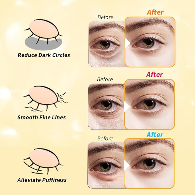 Under Eye Patches(25 Pairs), 24K Gold, Caffeine, Retinol Eye Masks for Puffy Eyes, Wrinkles, Dark Circles, Undereye Bags Treatment - Restoring & Awakening & Moisturizer Skin care Gift for Women