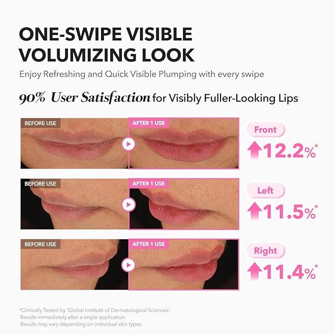 APRILSKIN Hero All Day Plumping Lip Stain | 24H Long-Lasting | Quick Visible Plumping for Fuller-Looking Lips | Smudge-Proof & Transfer Proof Wipe-Off Tint | Natural Rose | 0.14oz