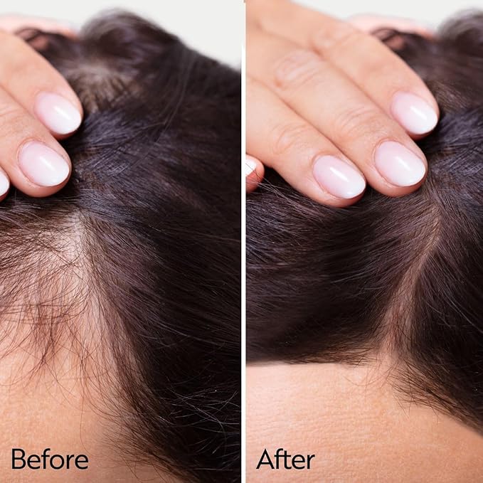 Ahuhu ESSENTIAL ANTI-AGE Elixir With Caffeine & Redensyl (100ml) - Highly Concentrated Scalp Care, Stimulates Hair Growth, Provides Thicker Hair & More Volume, Vegan