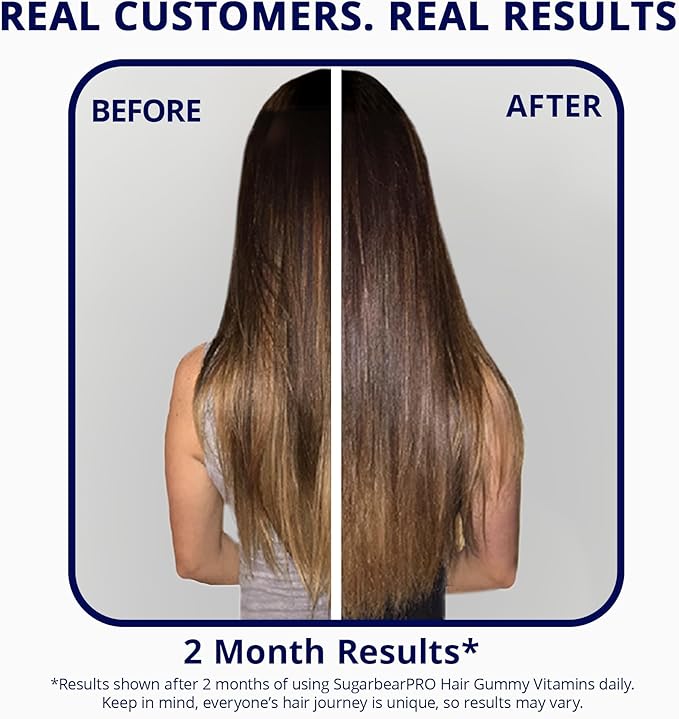 SugarBearPro Hair Vitamin Gummy 3 Month Supply Extra Strength Biotin 6000mcg, Growth for Men & Women, Vegan Vitamin B12, MSM, Inositol, Omega 3, Elderberry, Certified Kosher, Halal, Cruelty-Free
