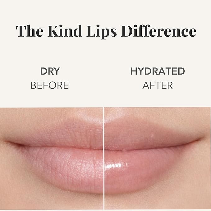 Kind Lips Unscented Organic Lip Balm Fragrance Free Unflavored Natural Moisturizing Lip Care 5 Pack