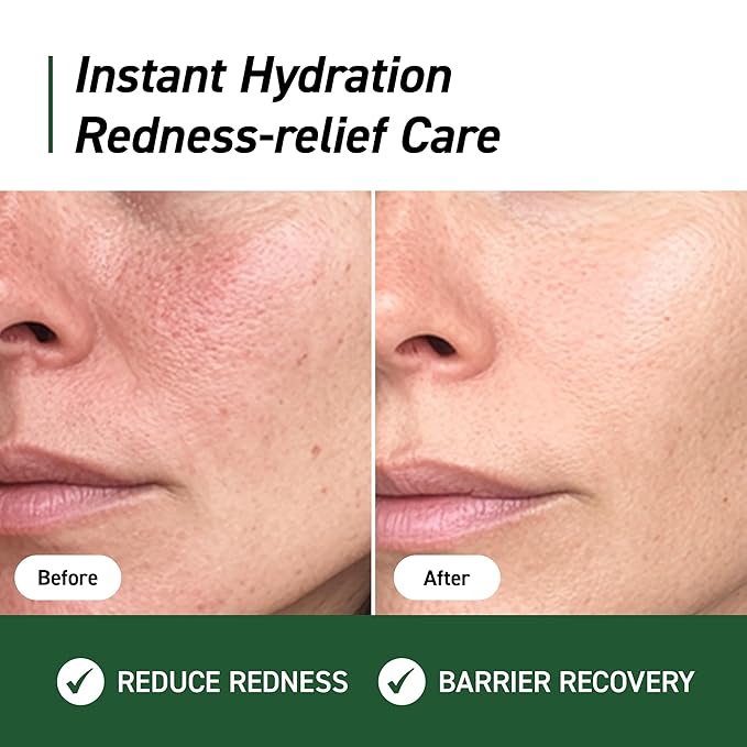 Cica Redness Relief Treatment Cream, Soothing & Hydrating Green Correcting Moisturizer with Madecassoside, Helps Repair Skin Barrier for Sensitive Skin, Vegan, Korean Skincare (1.76oz / 50g)