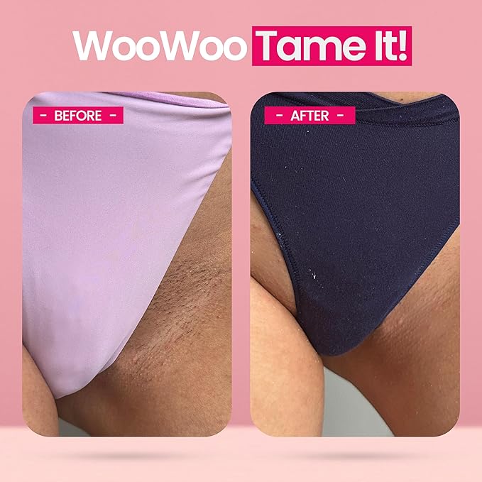 WooWoo Tame It! Natural Intimate Hair Removal Cream - Painless Vegan Hair Remover For Sensitive Skin - Depilatory For Genitals, Bikini, Legs & Bum - Women In-Shower Cream With Aloe Vera - 100ml