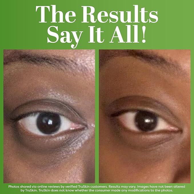 TruSkin Peptide Eye Cream Gel for Dark Circles & Fine Lines - Lightweight Under Eye Gel with Peptides & Hyaluronic Acid - Hydrating & Smoothing Eye Care for Tired-Looking Eyes, 0.5 Fl Oz