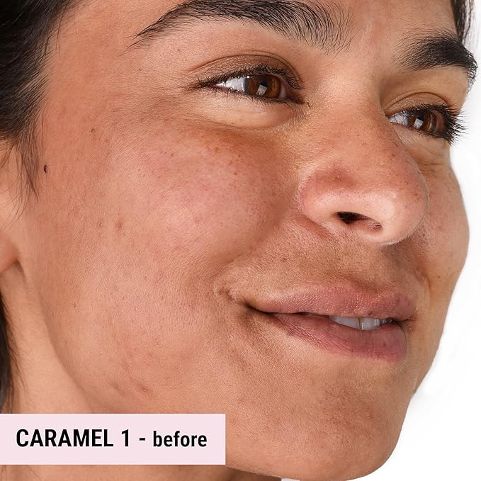 The Good Mineral Loves-You-Back 3in1 Mineral Powder Foundation (CARAMEL 1) | Designed for acne-prone, sensitive skin reducing the appearance of acne and scars without layers | Vegan + Cruelty Free