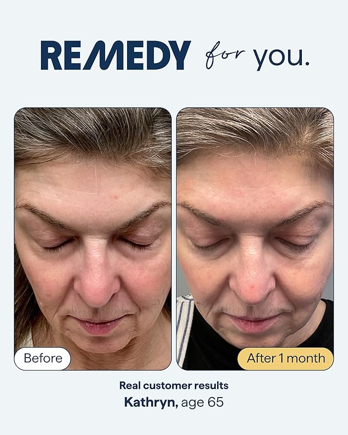 Remedy for Healthy Aging - Retinal, Resveratrol, Glycolic Acid, Argireline, Ferulic Acid, Matrixyl 3000 - Anti-Aging Treatment for Wrinkles, Uneven Texture & Tone - By Dermatologist Dr. Shah