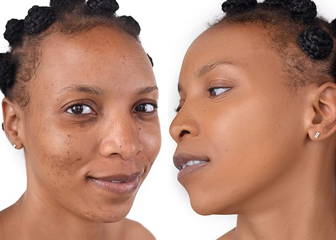 The Good Mineral Loves-You-Back 3in1 Mineral Powder Foundation (CARAMEL 2) | Designed for acne-prone, sensitive skin | 3IN1 - Concealer, Foundation + Powder | No skin agitation with calming Zinc Oxide