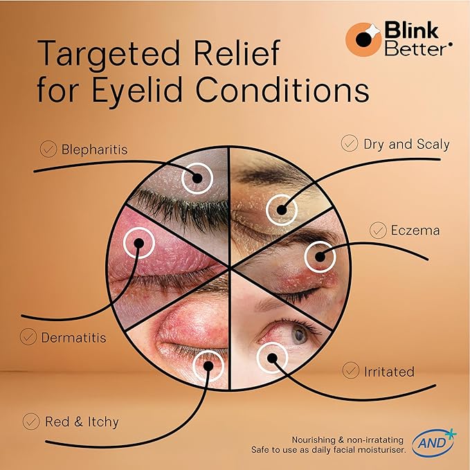 BetterLids Restore Eyelid Cream – Barrier Support to Hydrate, Soothe & Moisturise Dry, Itchy, Red & Sensitive Eyelids – Lightweight Daily Formula with 3% Oat & Ceramides, 1 fl oz