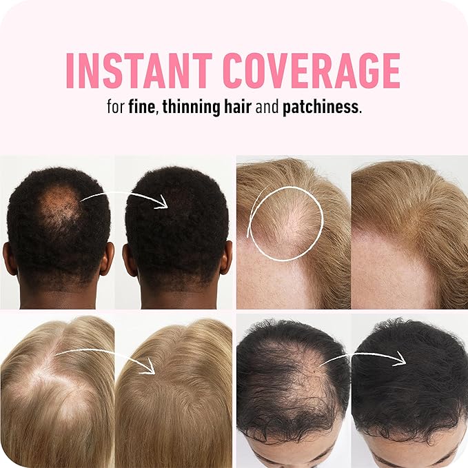 BOLDIFY Hair Fibers (28g) - Fill In Thinning and Fine Hair for an Instantly Fuller, Thicker Look - 14 Shades for Women & Men - Dark Auburn