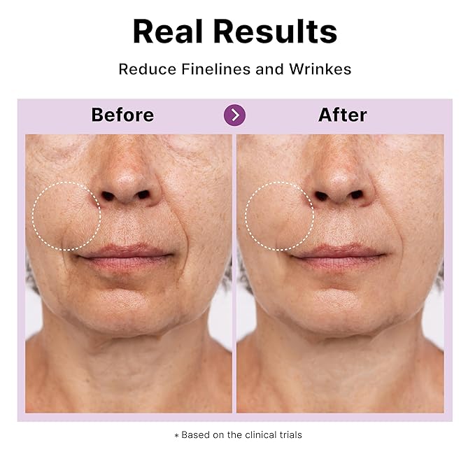 Multi Peptide Complex Serum, Matrixyl 3000, Argireline, Vegan Collagen, Niacinamide, Hyaluronic Acid for Anti-Aging, Anti-Wrinkles, Collagen Boost for Elasticity, Korean Skincare, 1Fl Oz