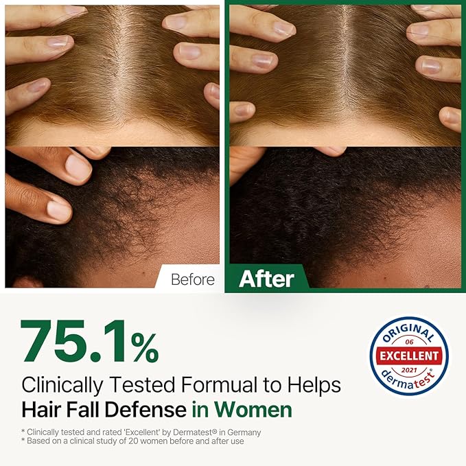 Alpha Erguen Women’s Hair Loss Care Shampoo, Vegan & Nutrient-Rich Formula, Repairs, Strengthens & Thickens Fine Hair, Deep Cleansing & Scalp Care with Plant-Based Extracts, 500ml / 16.9 fl oz