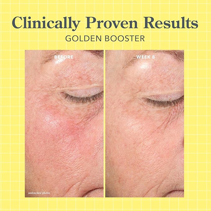 Beekman 1802 Golden Booster Amla Berry Face Serum – Plant-Based Vitamin C Alternative – Brightening & Tone-Evening Serum – Helps Reduce the Look of Dark Spots – Sensitive Skin Safe – 0.5 fl oz